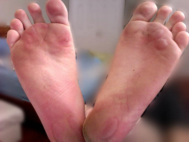 Barefoot on a Treadmill
